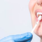 tooth filling cost singapore