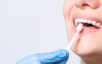tooth filling cost singapore