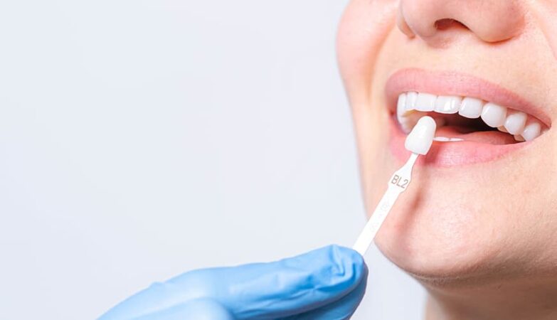 tooth filling cost singapore