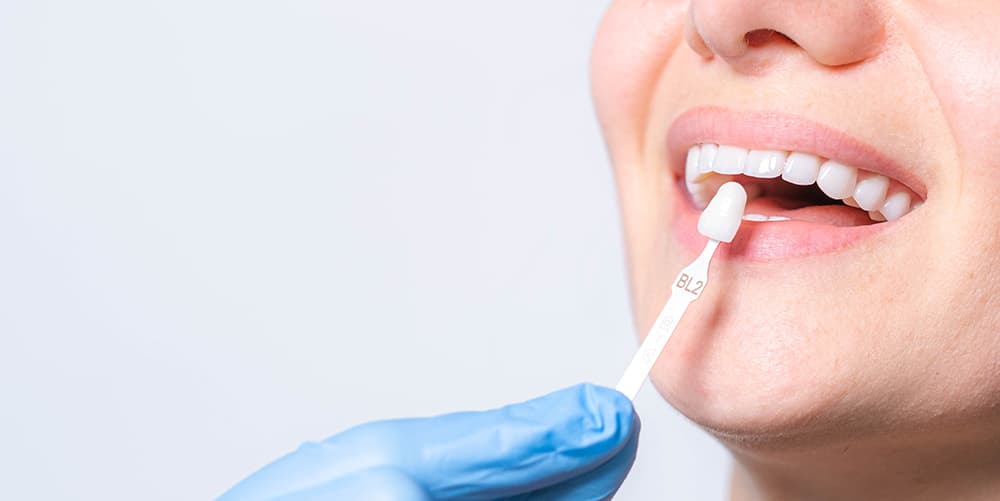 Discussing The Factors That Influence Tooth Filling Costs